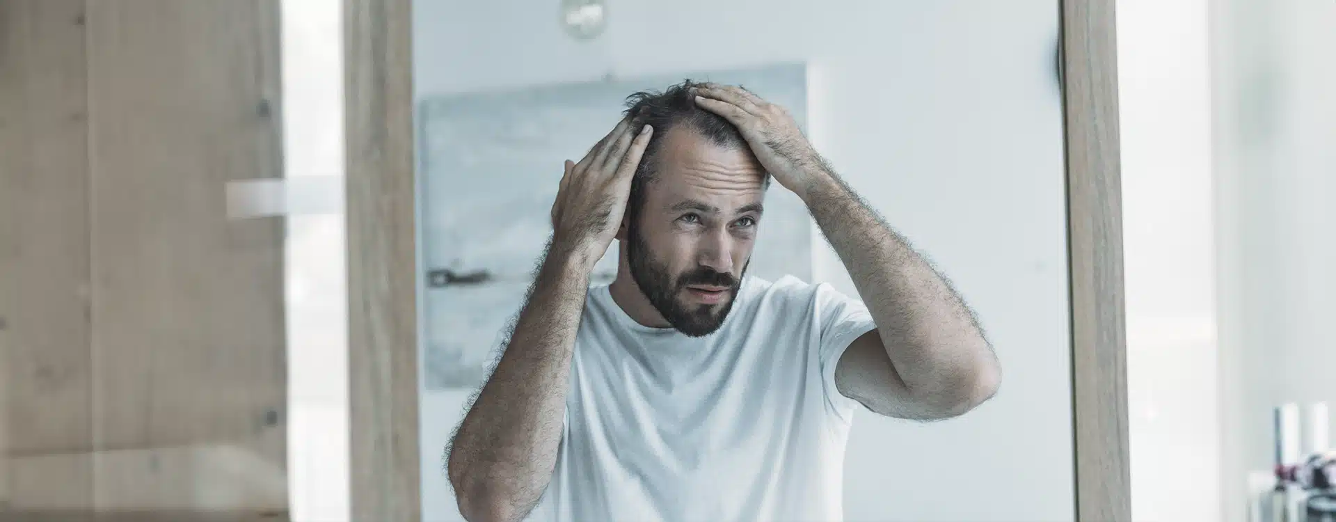 Tratamentos para Calvície Masculina